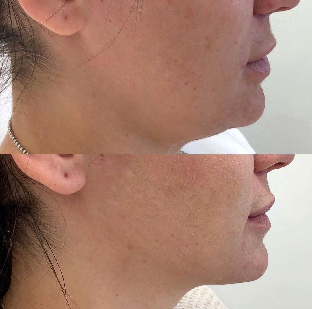 Pack Auralezzi Contour