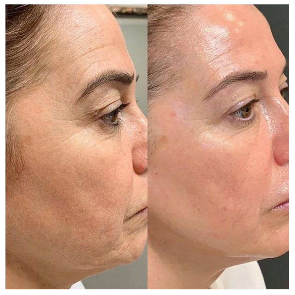 ⭐ Auralezzi Tonificación y Rejuvenecimiento – Pack Antiage Completo